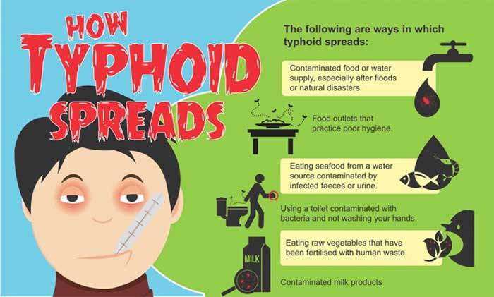 All you need to know about typhoid fever