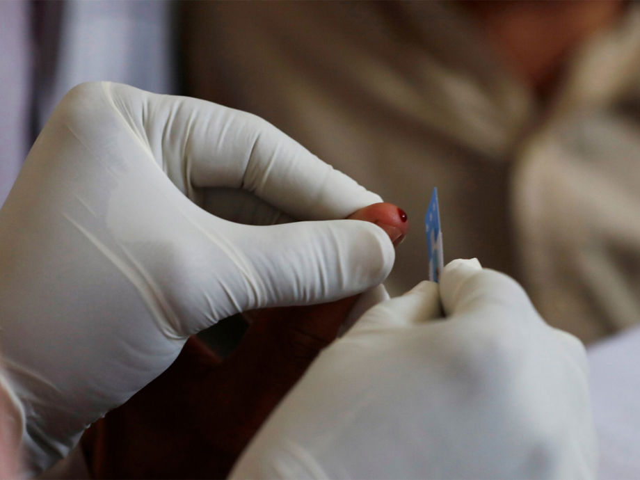 HIV Crisis Escalates in Pakistan: 80 Infected at Karachi Hospital  Devdiscourse