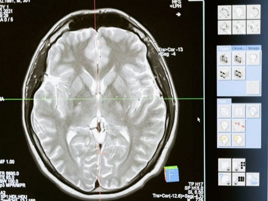 Octopus Mri Octopus and human brains have surprising similarity and here is why ...