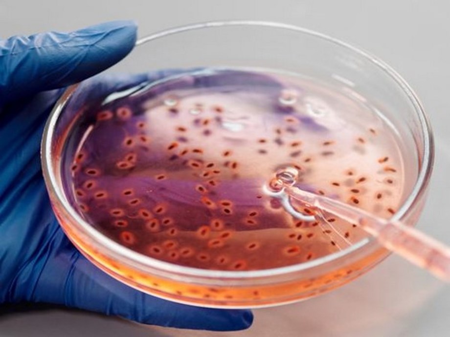 To treat infections, visible light activates molecular machineries: Study To treat infections, visible light activates molecular machineries: Study