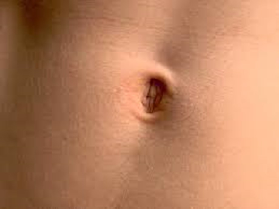 Innies, outies and omphalophobia: 7 navel-gazing questions about belly buttons answered Innies, outies and omphalophobia: 7 navel-gazing questions about belly buttons answered