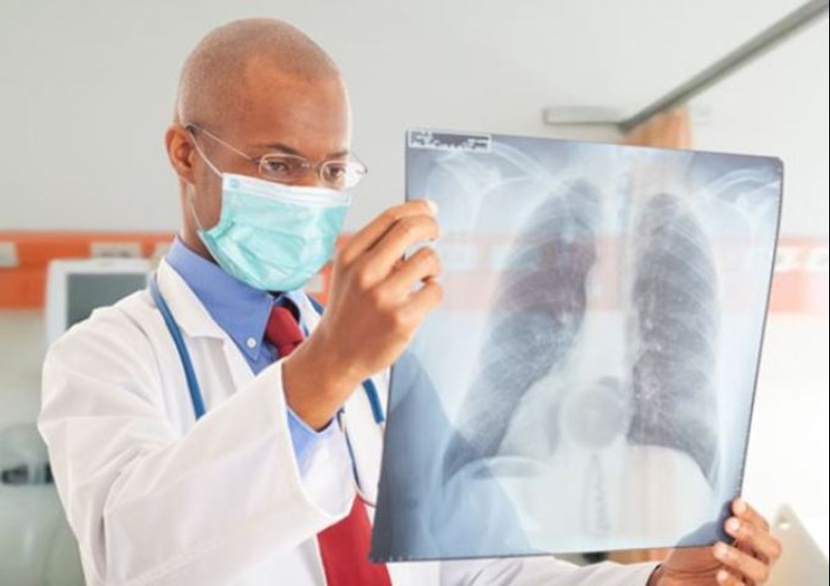 UN health agency appeals to reverse gains lost in fight against tuberculosis UN health agency appeals to reverse gains lost in fight against tuberculosis