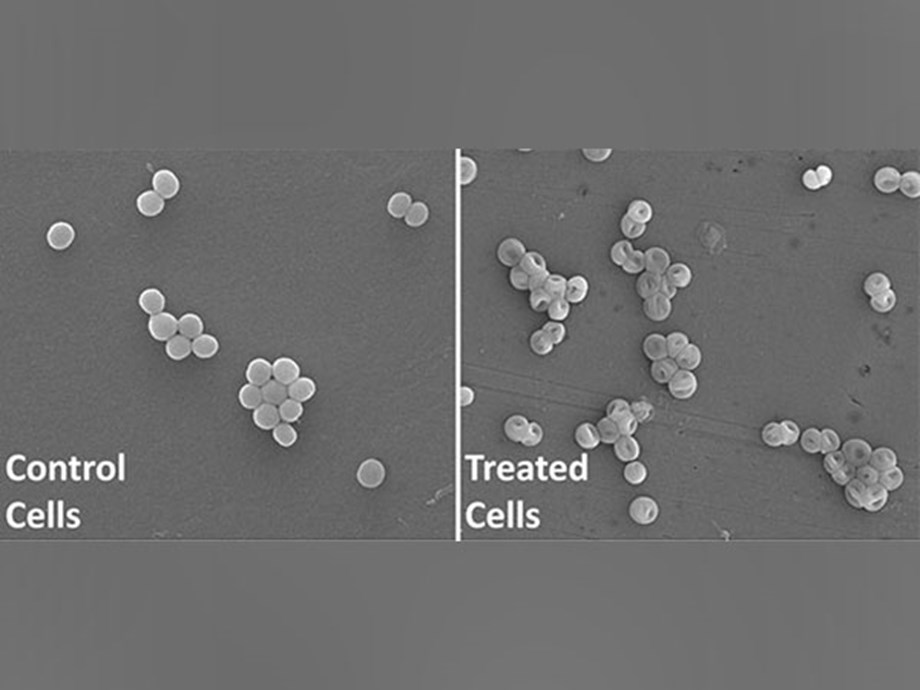IIT Roorkee researchers discover new antibacterial molecule against superbugs IIT Roorkee researchers discover new antibacterial molecule against superbugs