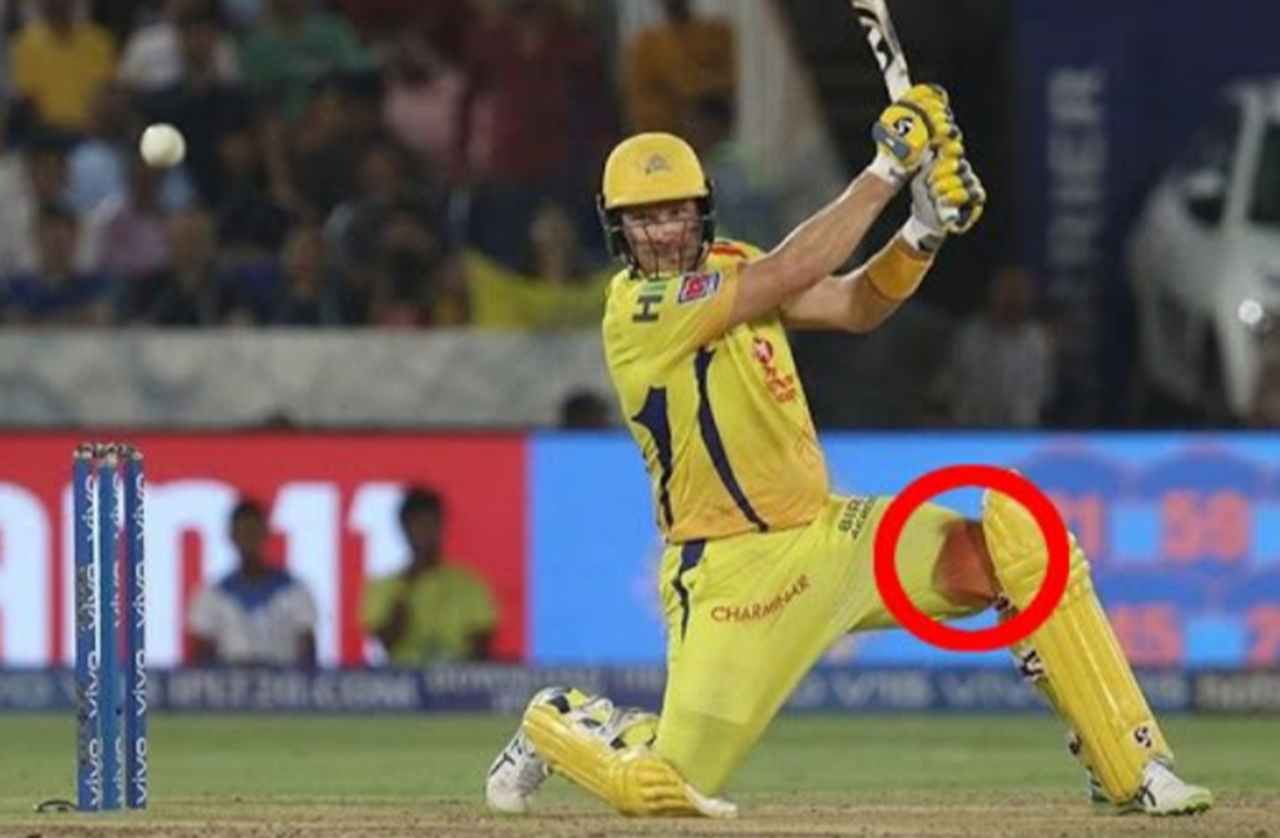Fact Check: Shane Watson's 'bleeding knee' picture from IPL final real or  fake? | Sports-Games