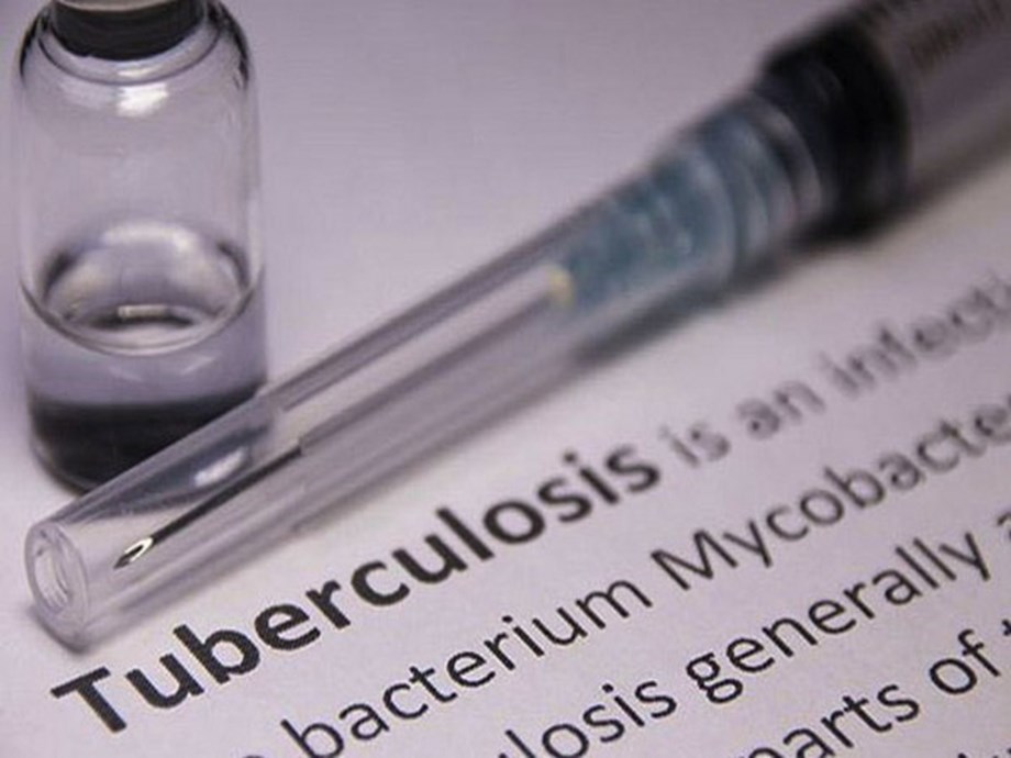 Sebuah penelitian telah menemukan bahwa jenis tuberkulosis yang berbeda dapat menyerang paru-paru