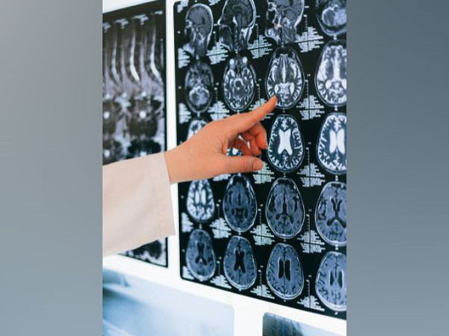 Redundant modular network supports proper brain communication: Study Redundant modular network supports proper brain communication: Study