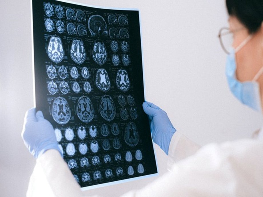 El cerebelo contribuye a funciones cognitivas superiores: estudio