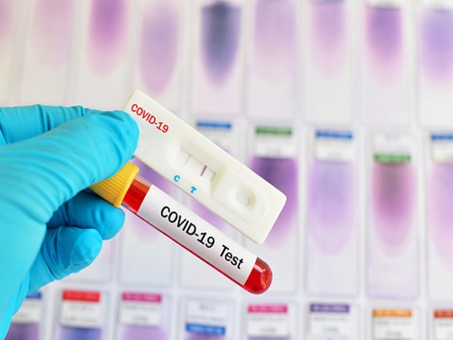 New COVID-19 rapid test kit receives scientific seal of approval New COVID-19 rapid test kit receives scientific seal of approval