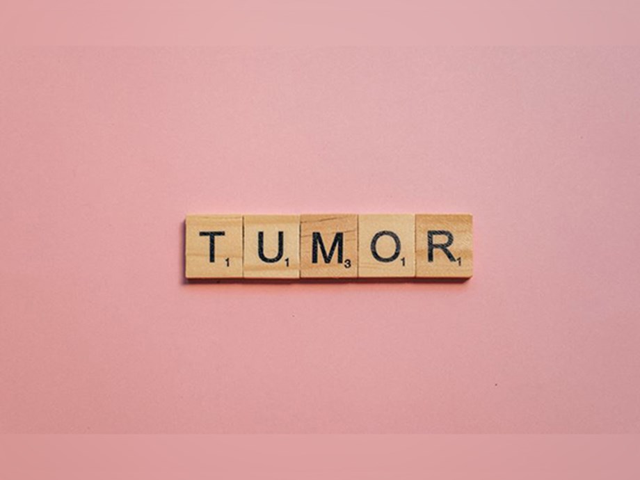 Study finds tumors suppress the development of metastases Study finds tumors suppress the development of metastases