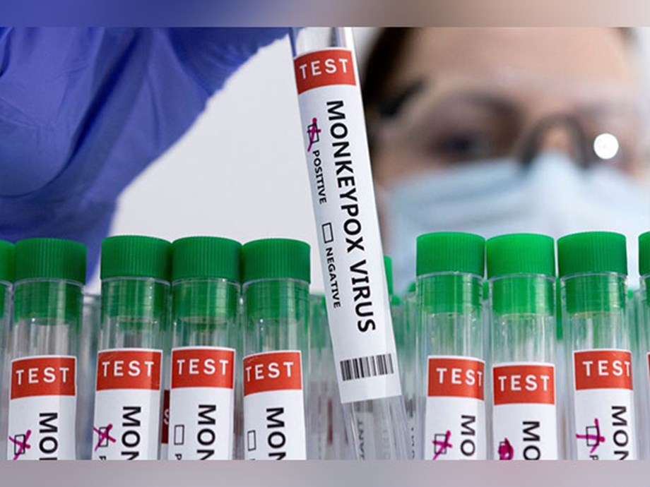 Spain reports second monkeypox-related death in Europe Spain reports second monkeypox-related death in Europe