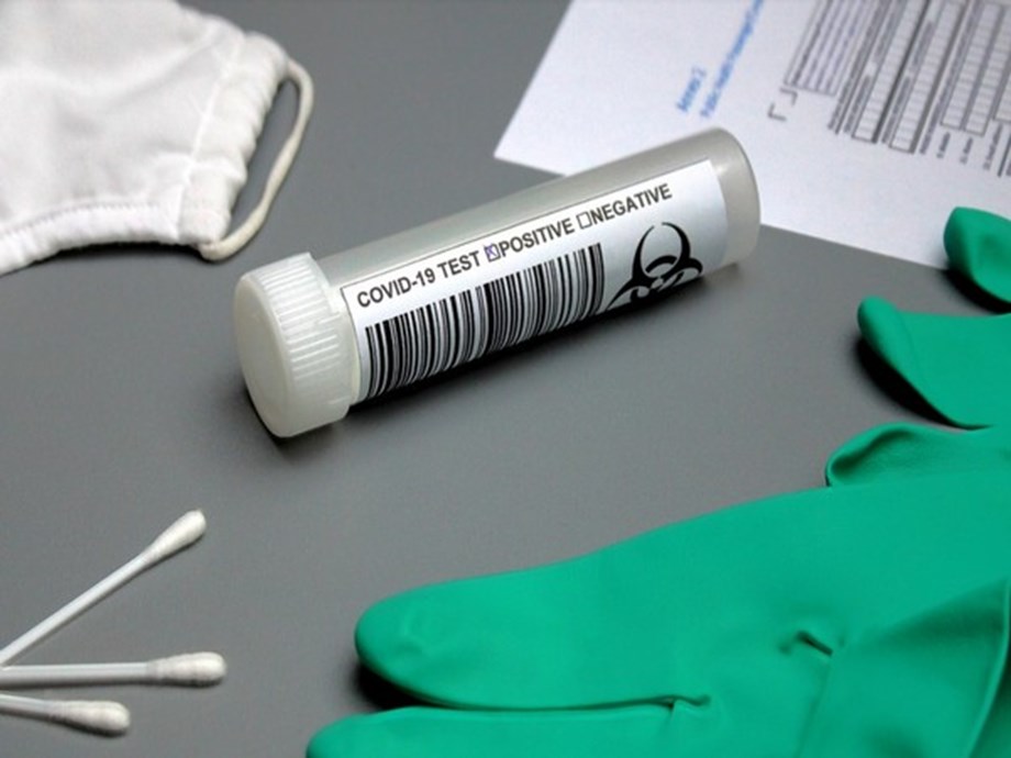 Researchers create new test to quickly identify COVID-19 infection and severity Researchers create new test to quickly identify COVID-19 infection and severity