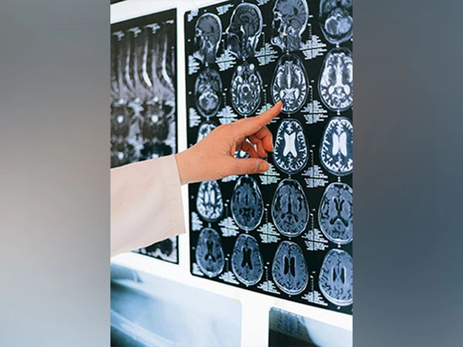 Is Brain Learning Slower than Artificial Intelligence? Is Brain Learning Slower than Artificial Intelligence?